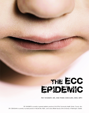 The ECC Epidemic Case Study 